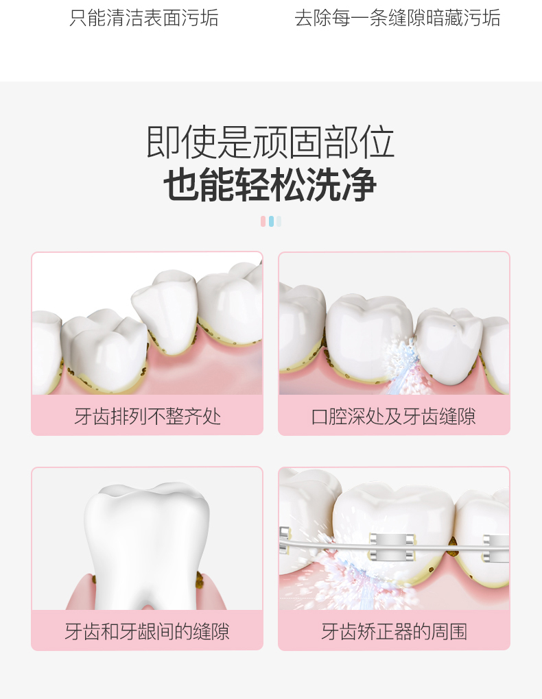 南宫28登录入口迷你型洗牙器